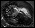 Nucleus