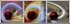 Coronary Triptych