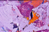 Abstract 16
