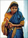 Leprosy Patient - Bengal