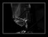 DTXpress IV / The Millenium Double Bass 3