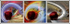 Coronary Triptych