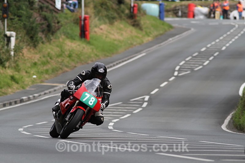 FOM_5113 - Supertwin/Lightweight MGP